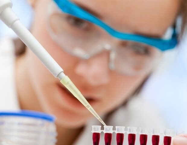 picture20162f32fblood_testing_6c4f4bff47c24f5ba754ed98c75bd512-620x480-8351910