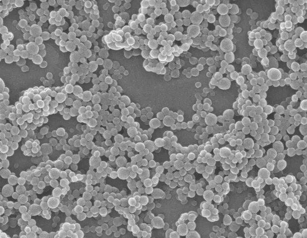 picture20142f72fplga_nanoparticles_for_delivery_of_drugs-620x480-9706724