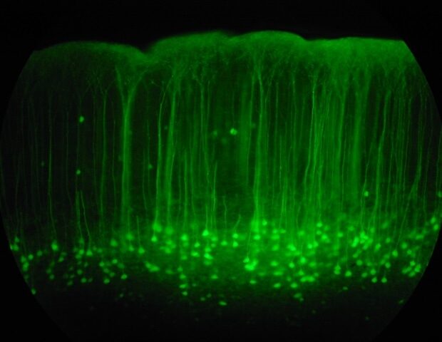 picture20172f62fsomatosensory_cortex_mouse_brain_slice_gfp_-_robert_cudmore-_commons-wikimedia-org_3fb90d51b38b45429cb5182ed3998fd0-620x480-3962487