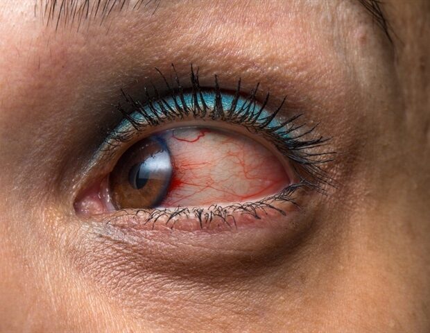 picture20192f92fgirl_red_eye_-_image_-_sruilk_m1_0afc2f7a26e64fe08fb4663ac0ed0a66-620x480-9773522