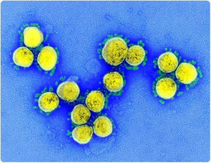 SARS-CoV-2 - Micrographie électronique à transmission de particules de virus SARS-CoV-2, isolée d'un patient. Image capturée et rehaussée de couleurs au NIAID Integrated Research Facility (IRF) à Fort Detrick, Maryland. Crédits: NIAID picture20202f32f4049645120251_ee9b0312bc_h-6689838