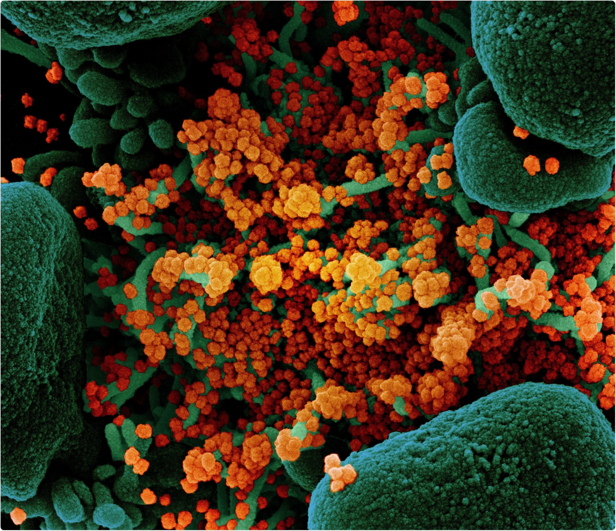 Nouveau coronavirus SARS-CoV-2 Micrographie électronique à balayage colorisée d'une cellule apoptotique (verte) fortement infectée par des particules de virus SARS-COV-2 (orange), isolée d'un échantillon de patient. Image au NIAID Integrated Research Facility (IRF) à Fort Detrick, Maryland. Crédits: NIAID