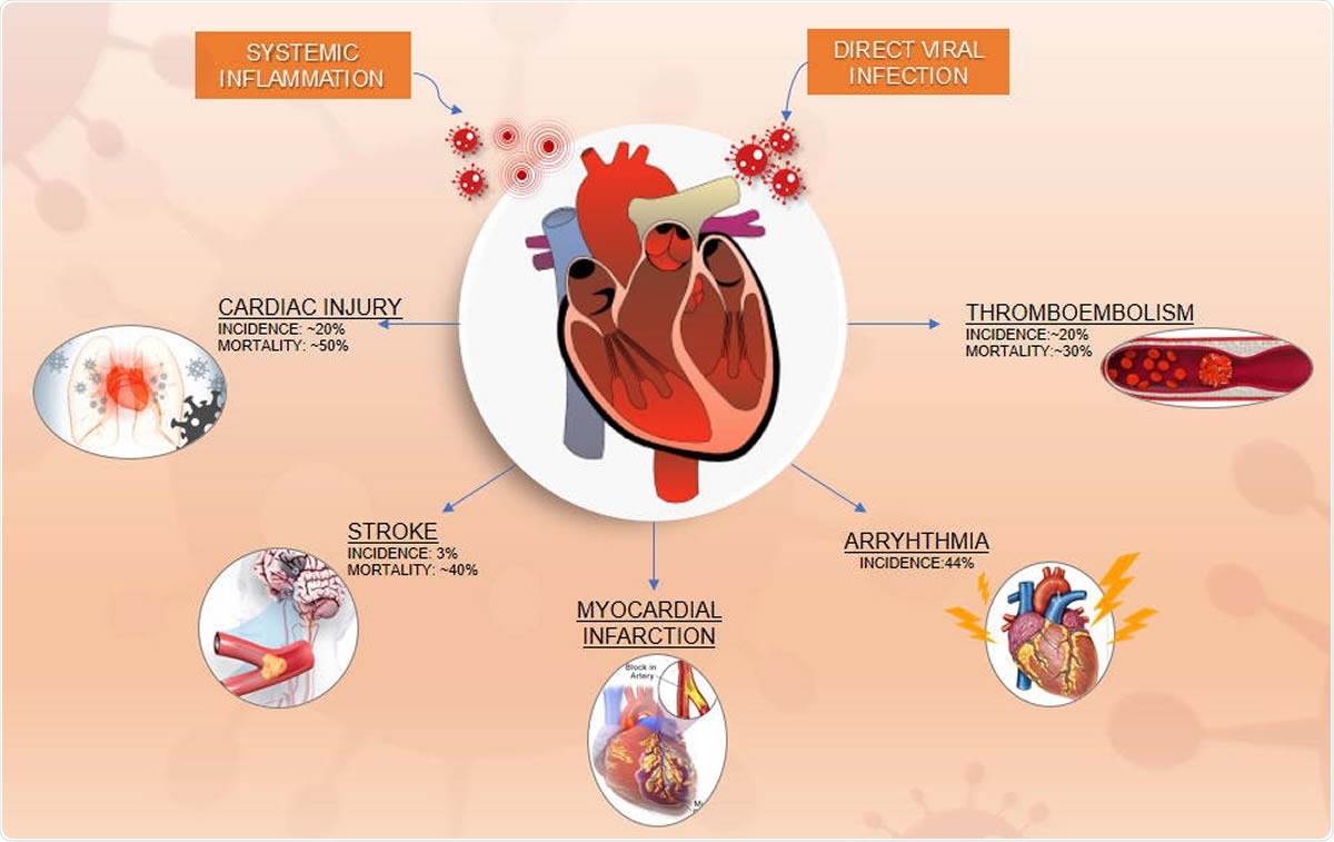 Manifestations cardiovasculaires et résultats dans le contexte de la maladie COVID-19