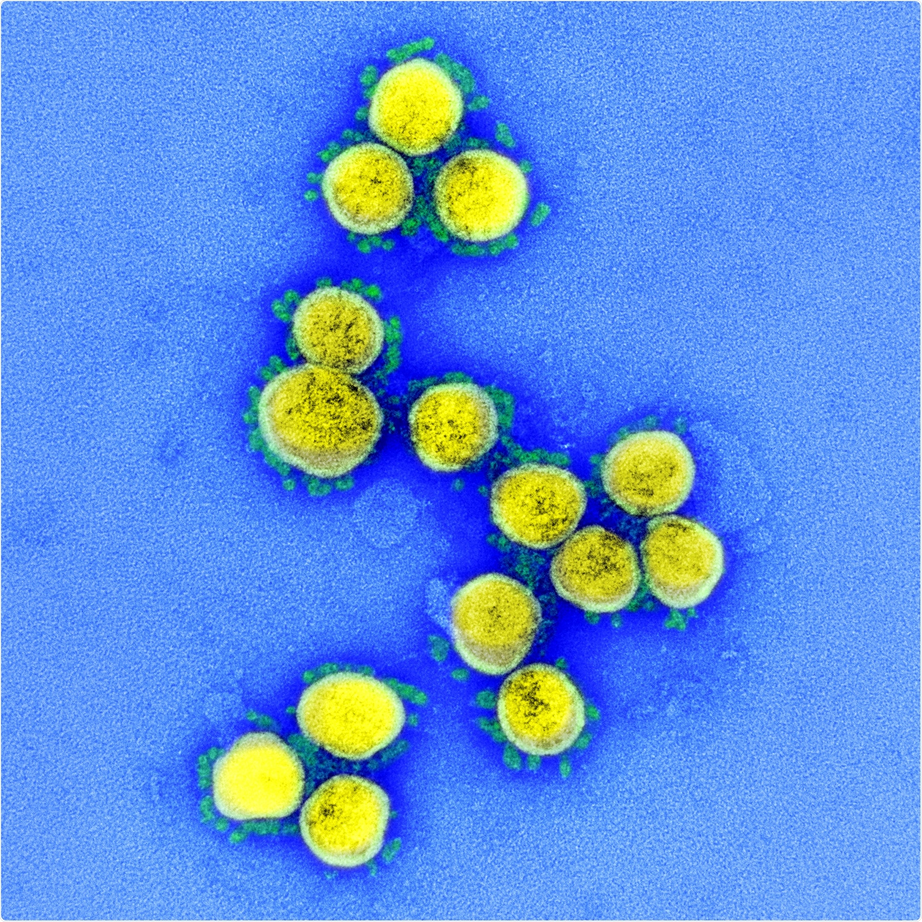 Nouveau coronavirus SARS-CoV-2 Micrographie électronique à transmission de particules de virus SARS-CoV-2, isolées d'un patient. Image capturée et mise en valeur des couleurs au centre de recherche intégré (IRF) du NIAID à Fort Detrick, Maryland. Crédit: NIAID