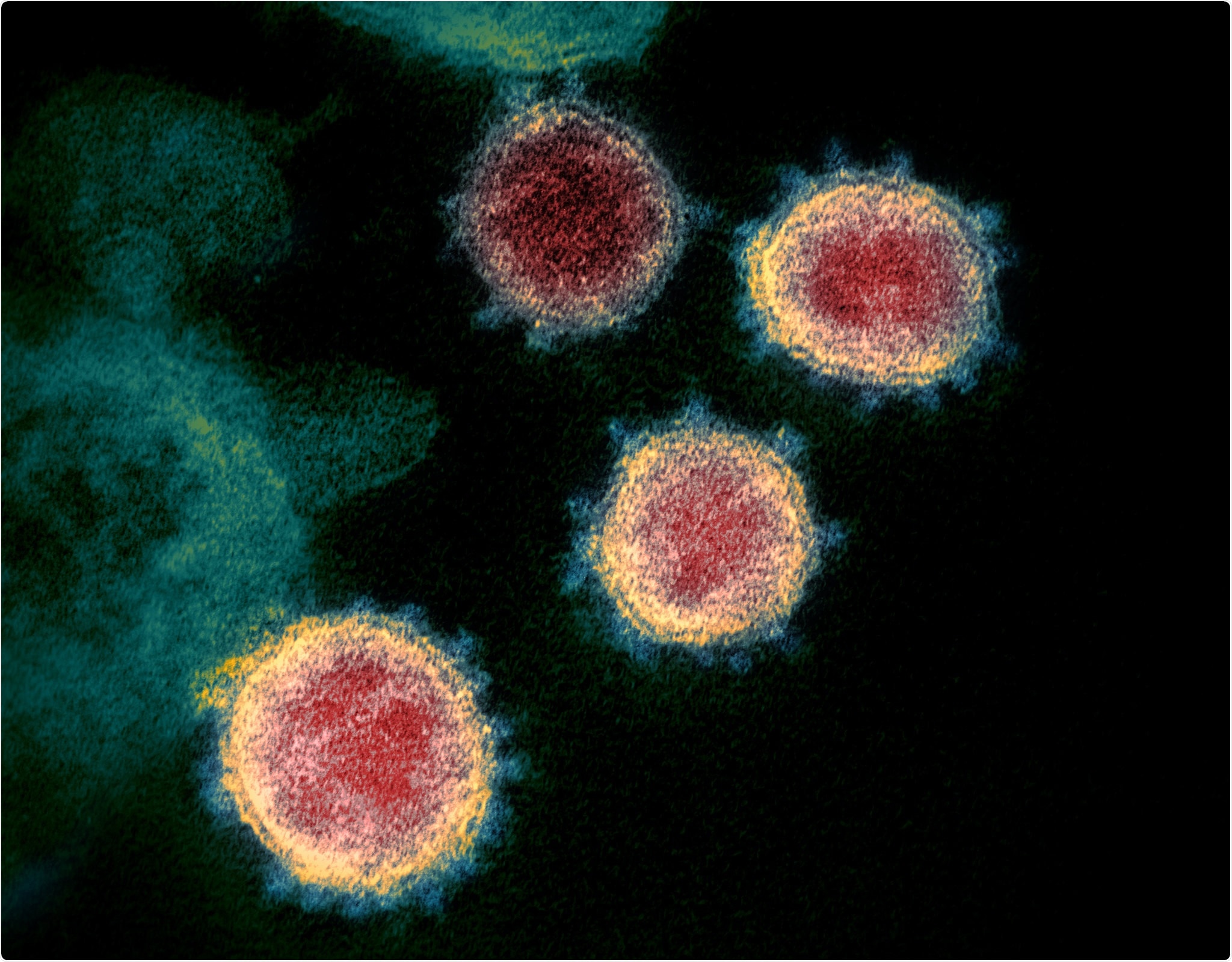 Cette image au microscope électronique à transmission montre le SRAS-CoV-2 - également connu sous le nom de 2019-nCoV, le virus qui cause le COVID-19 - isolé d'un patient aux États-Unis.Des particules virales émergent de la surface de cellules cultivées en laboratoire. Les pointes sur le bord extérieur des particules virales donnent aux coronavirus leur nom, en forme de couronne. Image capturée et colorisée au NIAID