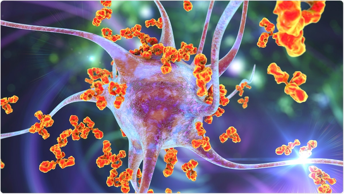 Étude: Auto-anticorps contre les IFN de type I chez des patients atteints d'un COVID-19 potentiellement mortel. Crédit d'image: Kateryna Kon / Shutterstock