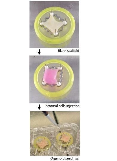 Les greffes intestinales cultivées à l'aide de cellules souches pourraient conduire à des greffes personnalisées pour les enfants