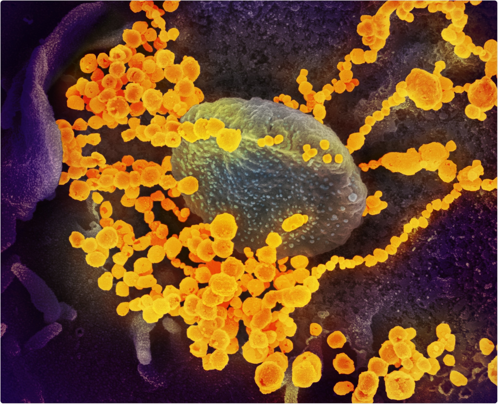 Cette image de microscope électronique à balayage montre le SRAS-CoV-2 (objets en or ronds) émergeant de la surface de cellules cultivées en laboratoire. SARS-CoV-2, également connu sous le nom de 2019-nCoV, est le virus qui cause le COVID-19. Le virus montré a été isolé d'un patient aux États-Unis. Image capturée et colorisée au NIAID
