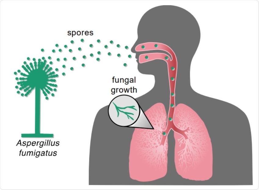 L'inhalation de spores d'Aspergillus peut entraîner une infection fongique.  L'inhalation de spores d'Aspergillus provenant de l'environnement peut se déplacer vers les poumons, puis se développer végétativement et se propager à d'autres parties du corps.