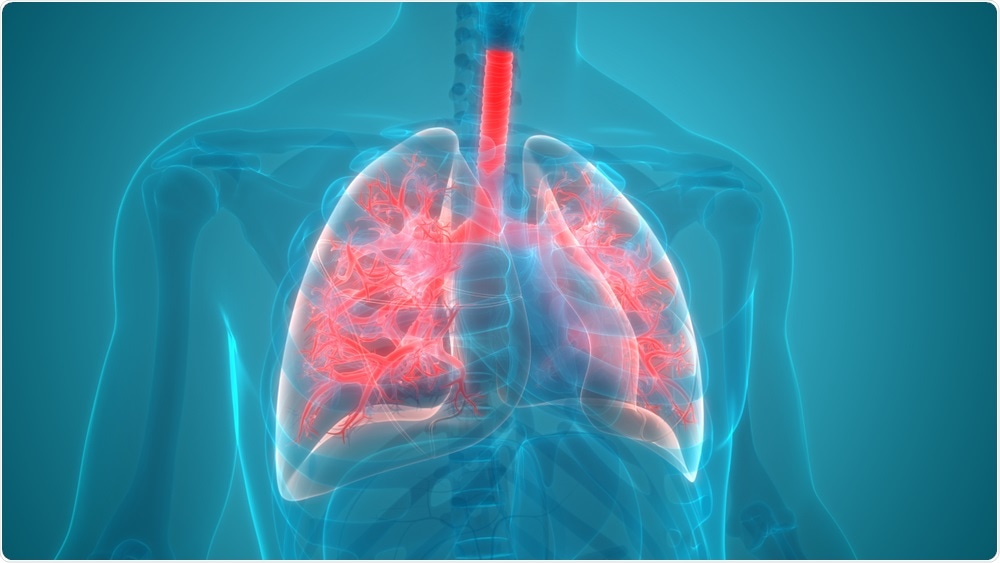 Pneumonie Pneumonie