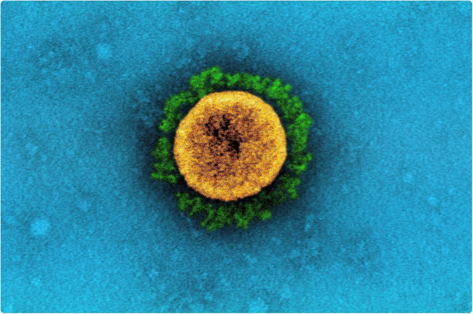 Etude: Longs déficits neuropsychologiques COVID après infection sévère, modérée ou légère.  Crédit d'image: NIAID