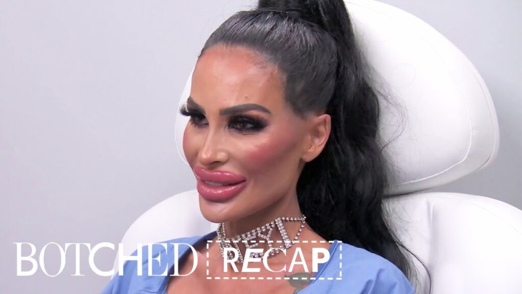 Botched