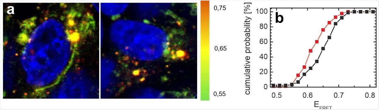 La distribution de αS dans les cellules SH-SY5Y est affectée par la protéine N.  a) Images FRET de cellules micro-injectées avec la sonde αS FRET.  Le code couleur représente EFRET (vert: EFRET bas; jaune: EFRET moyen; orange: EFRET élevé).  Le noyau cellulaire est contre-coloré avec du DAPI et visible en bleu.  Une image représentative des cellules co-injectées avec la protéine N et la sonde αS FRET est montrée à gauche, les cellules témoins à droite ont seulement été injectées avec la sonde αS FRET.  b) Distribution des efficacités FRET moyennes de αS par image pour toutes les cellules injectées avec la protéine N (rouge) et les cellules témoins (noir).  Les histogrammes cumulatifs contiennent des données d'au moins 80 images pour les échantillons témoins et les échantillons injectés de la protéine N.  L'efficacité FRET moyenne de αS dans les cellules injectées avec la protéine N est déplacée vers des valeurs EFRET inférieures.