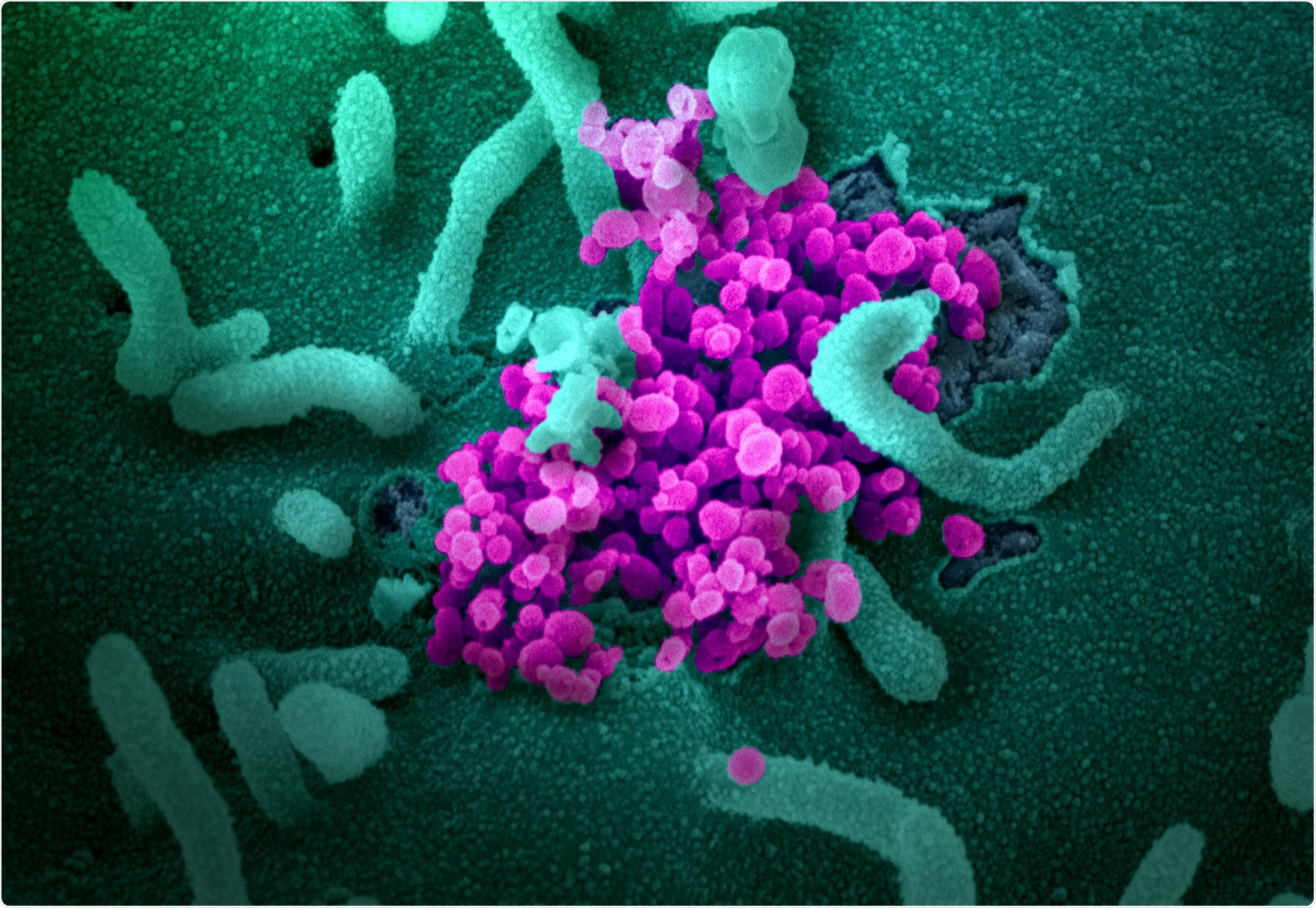 Étude: La protection d'une infection antérieure par le SRAS-CoV-2 est similaire à celle de la protection vaccinale BNT162b2: une expérience nationale de trois mois en Israël.  Crédit d'image: NIAID
