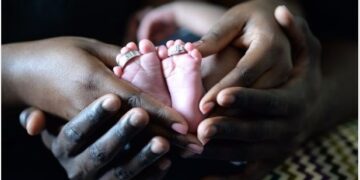 Survival for babies born with congenital anomalies depends on place of birth