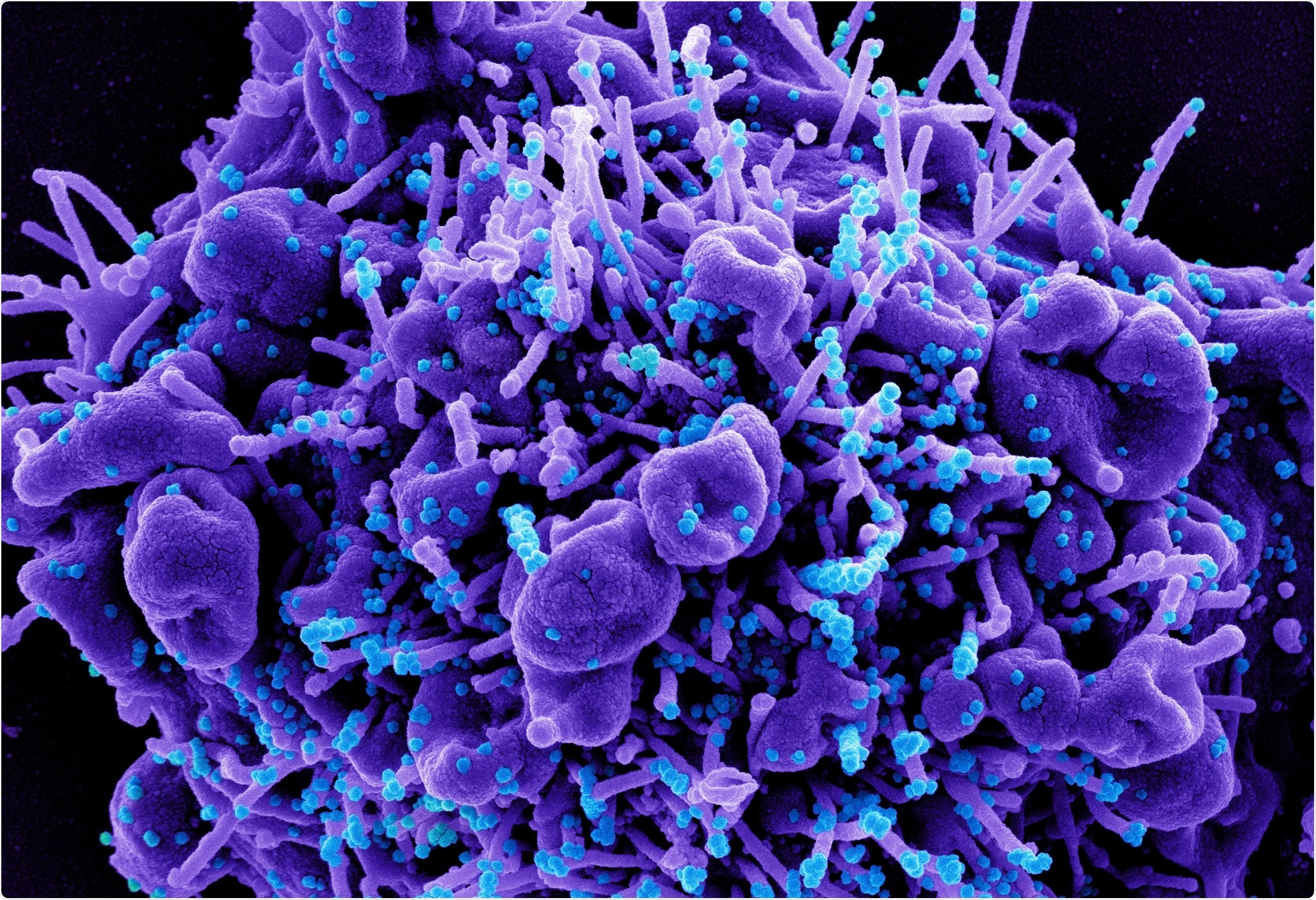 Study: Phylogenetic network analysis revealed the recombinant origin of the SARS-CoV-2 VOC202012/01 (B.1.1.7) variant first discovered in U.K. Image Credit: NIAID