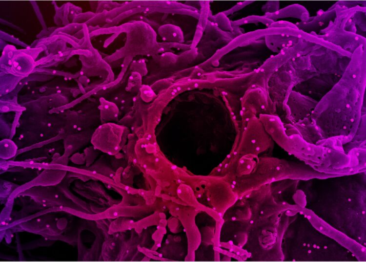 Study: SARS-CoV-2 Nsp3 unique domain SUD interacts with guanine quadruplexes and G4-ligands inhibit this interaction. Image Credit: NIAID