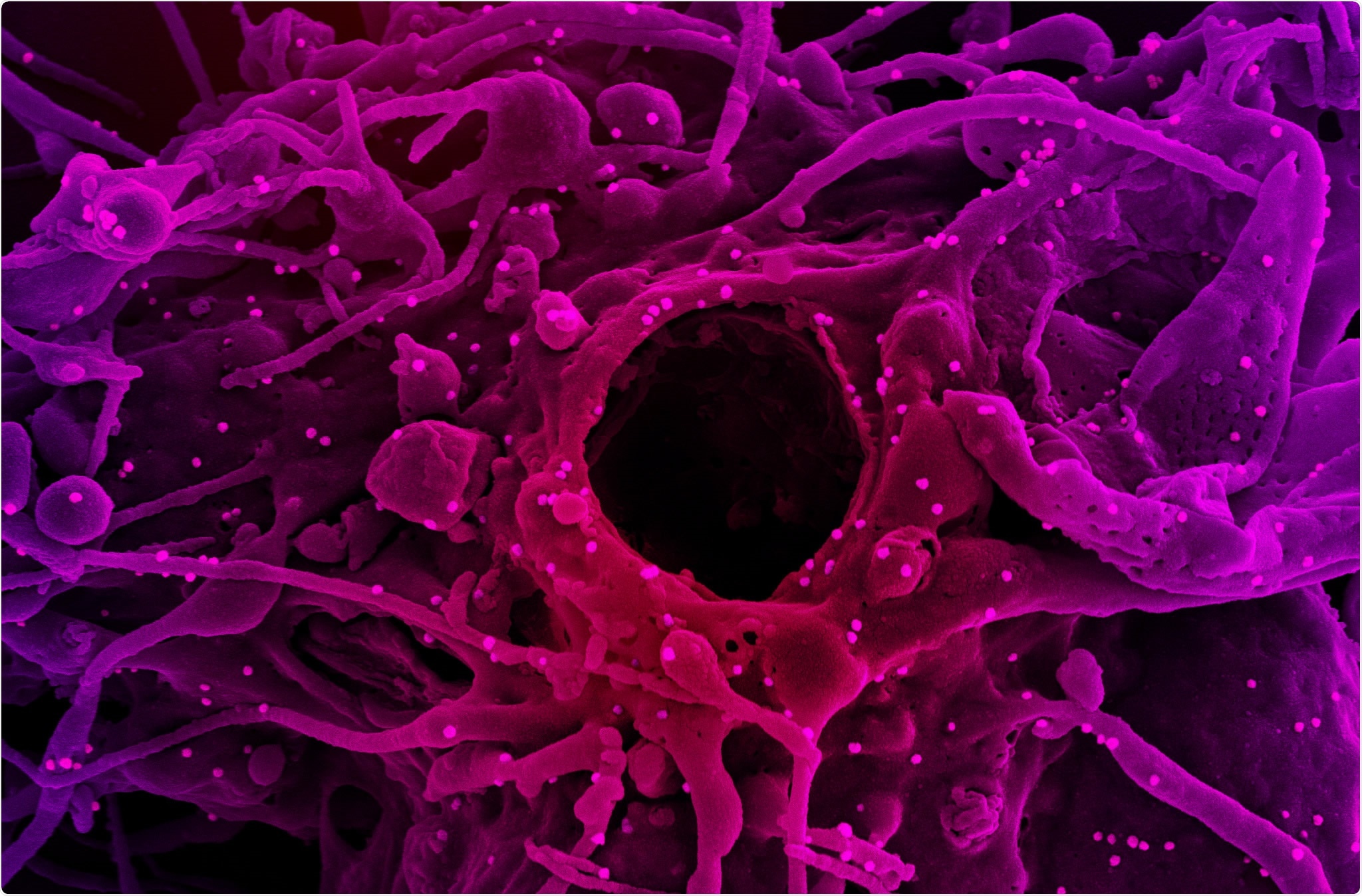 Study: SARS-CoV-2 Nsp3 unique domain SUD interacts with guanine quadruplexes and G4-ligands inhibit this interaction. Image Credit: NIAID