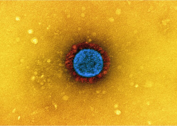 Study: Mutations in two SARS-CoV-2 variants of concern reflect two distinct strategies of antibody escape. Image Credit: NIAID