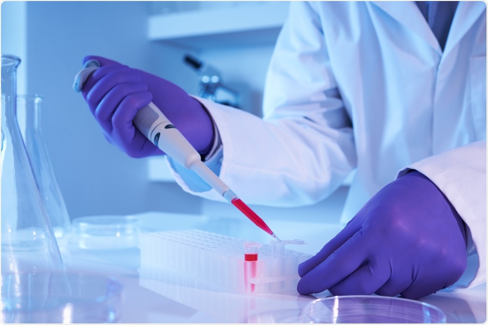 Évaluation des réponses vaccinales à ARNm avec un test de neutralisation virale SARS-CoV-2 de substitution