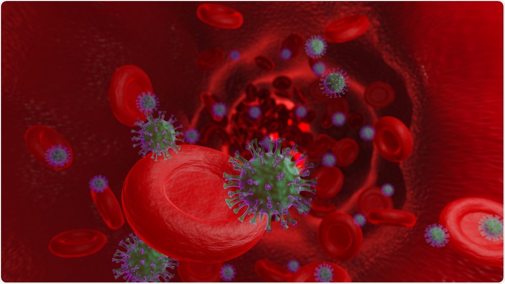 Le risque de thrombose veineuse est plus élevé dans l'infection par le SRAS-CoV-2 que dans la vaccination