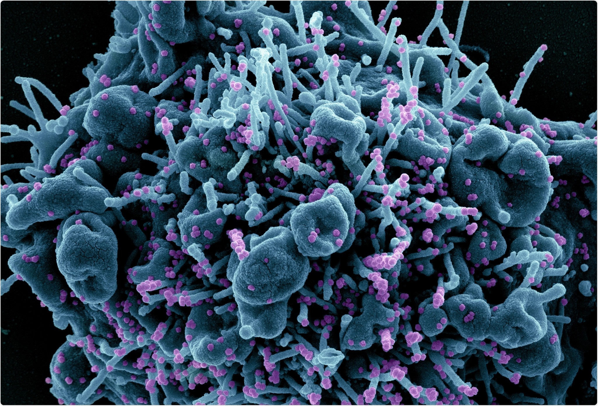 Study: Structural definition of a pan-sarbecovirus neutralizing epitope on the spike S2 subunit. Image Credit: NIAID
