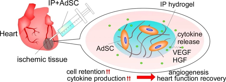 New stem-cell-carrying hydrogel could help the heart recover from myocardial ischemia