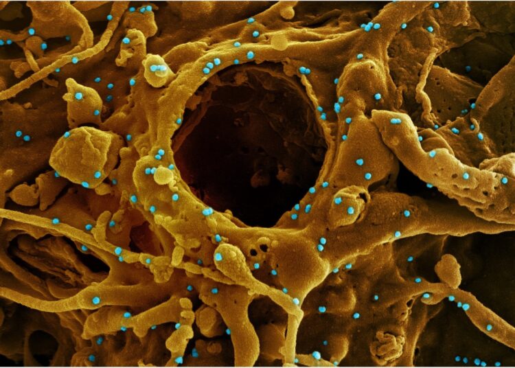 Study: Viral loads of Delta-variant SARS-CoV2 breakthrough infections following vaccination and booster with the BNT162b2 vaccine. Image Credit: NIAID