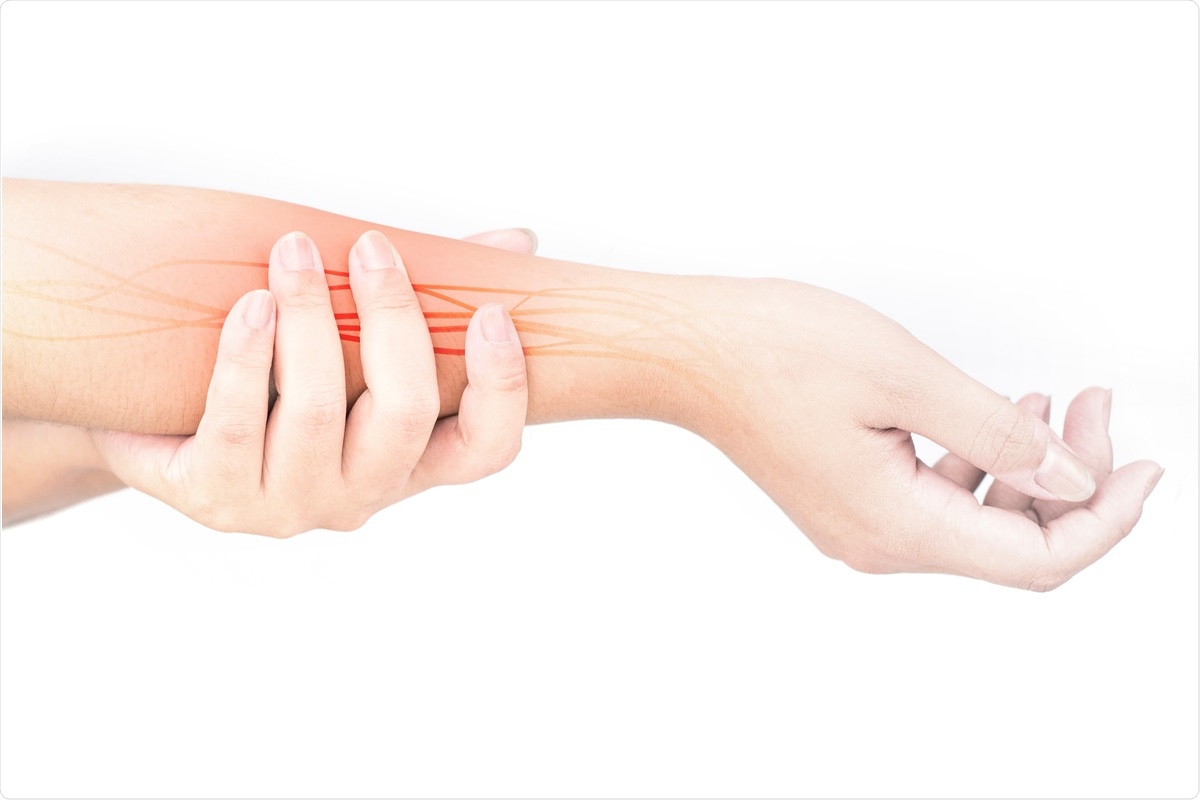 Study: Acquired peripheral nerve injuries associated with severe COVID-19. Image Credit: SoftSheep/ Shutterstock