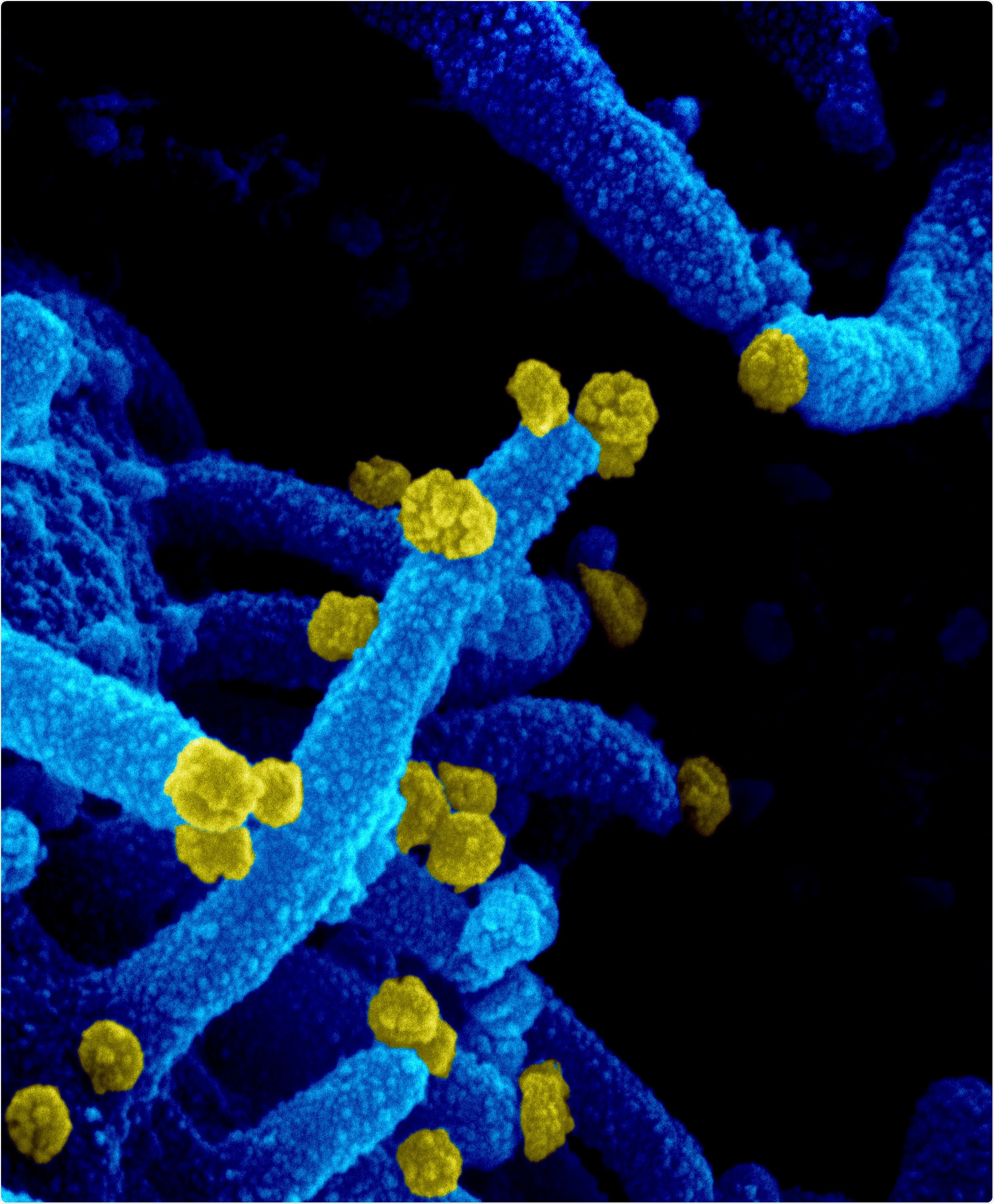 Study: Evidence of Persisting Autoreactivity in Post-Acute Sequelae of SARS-CoV-2 Infection. Image Credit: NIAID