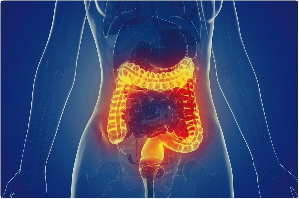 Study: Early immunologic response to mRNA COVID-19 vaccine in patients receiving biologics and/or immunomodulators. Image Credit: SciePro/ Shutterstock