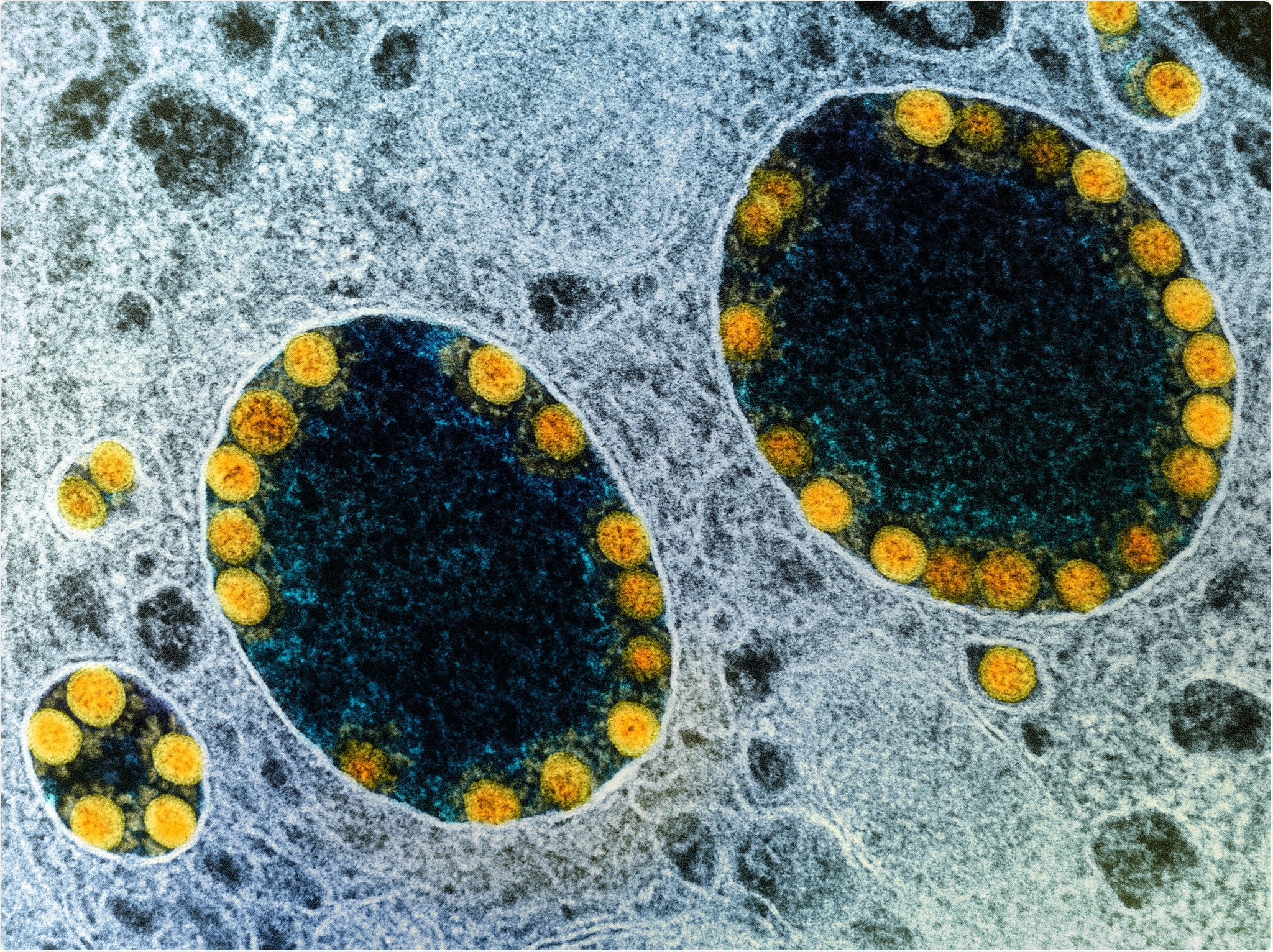 Study: Defining variant-resistant epitopes targeted by SARS-CoV-2 antibodies: A global consortium study. Image Credit: NIAID