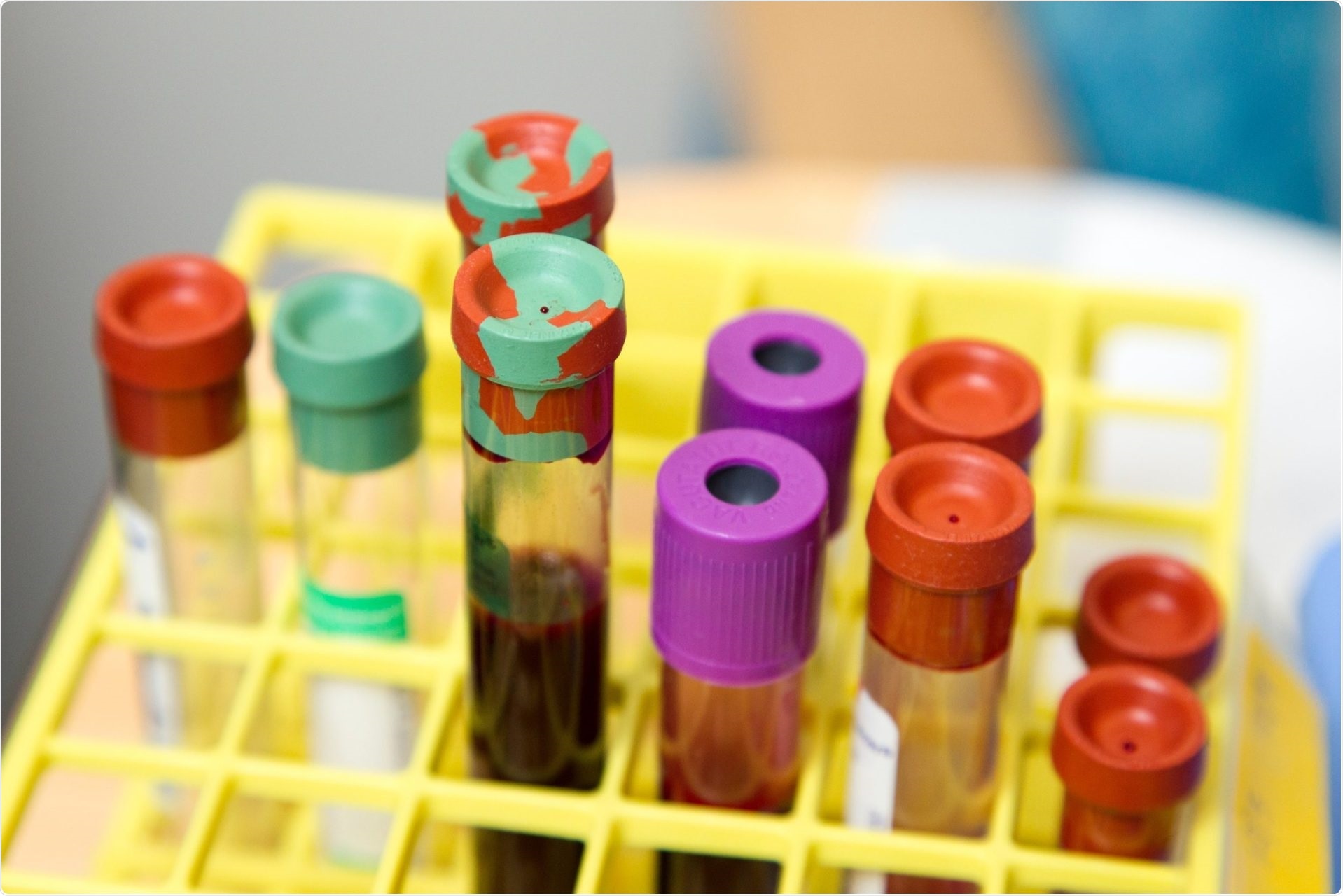 Research may lead to breakthroughs in combating cancer drug resistances