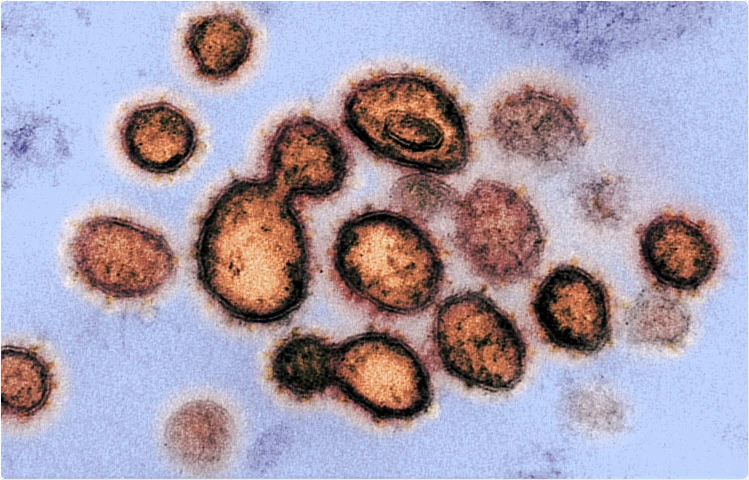 Study: The Immune Response to SARS-CoV-2 and Variants of Concern. Image Credit: NIAID