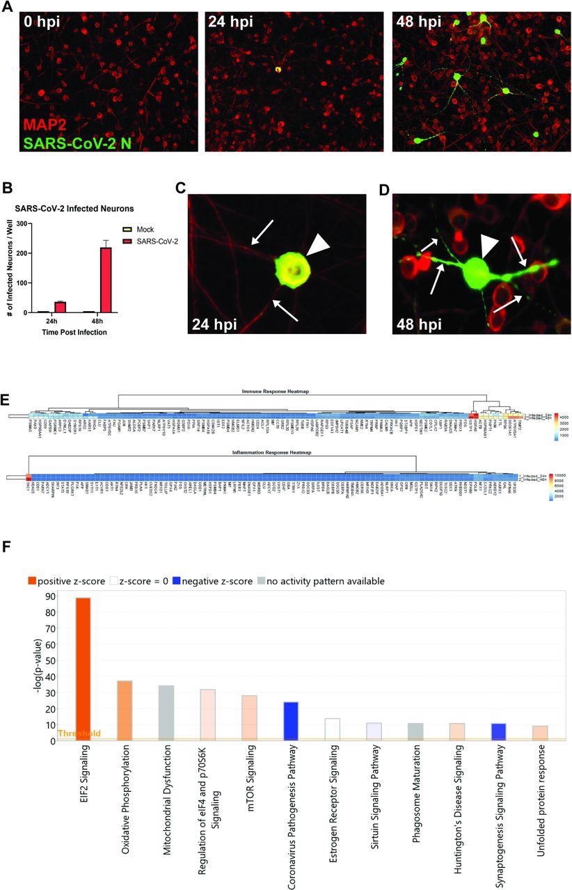 Le SRAS-CoV-2 infecte les neurones humains dérivés d'iPSC.  (A) Des neurones dérivés de hiPSC ont été infectés par le SRAS-CoV-2 à un MOI de 0,1, immunocolorés avec anti-MAP2 et anti-SARS-CoV-2 N, et imagés à 0, 24 et 48 heures après l'infection.  (B) Quantification de la fluorescence SARS-CoV-2 GFP des neurones dérivés de hiPSC infectés et infectés par le SARS-CoV-2.  (C) Réplication périnucléaire du SRAS-CoV-2 dans le soma neuronal (tête de flèche) mais pas de transport axonal viral (flèches) 24 heures après l'infection.  (D) Présence périnucléaire du SRAS-CoV-2 dans le soma (tête de flèche) et l'axone (flèches) 24 heures après l'infection.  (E) Carte thermique des gènes exprimés 24 et 48 h après l'infection.  (F) Top 12 des voies canoniques montrant des changements progressifs de 24 à 48 h après l'infection.