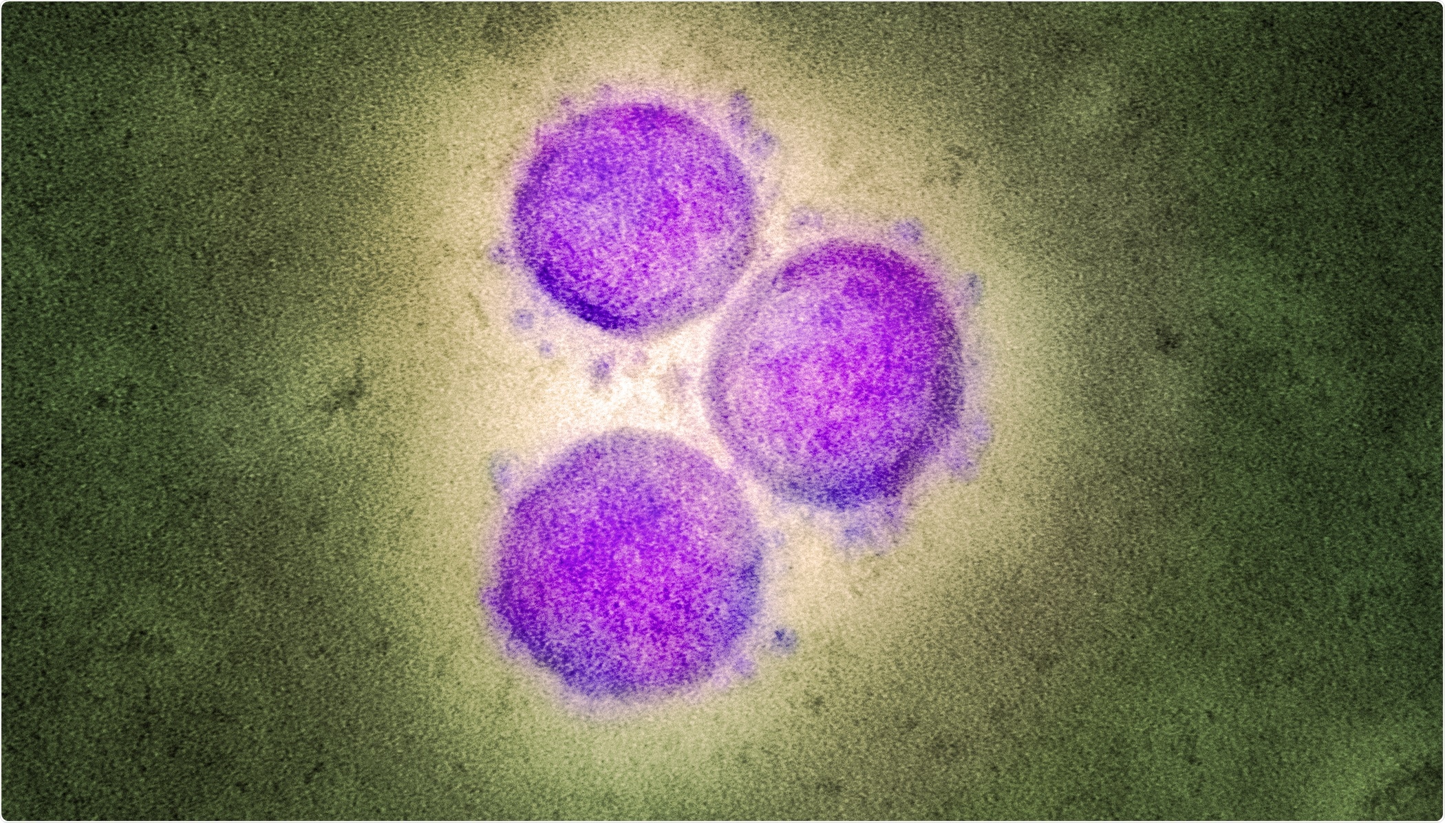 Study: Effect of the Neutralizing SARS-CoV-2 Antibody Sotrovimab in Preventing Progression of COVID-19: A Randomized Clinical Trial. Image Credit: NIAID