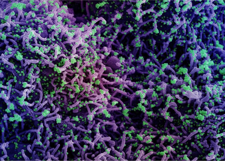 Study: The Chaotic Behavior of the Spread of Infection During the COVID-19 Pandemic in the United States and Globally. Image Credit: NIAID