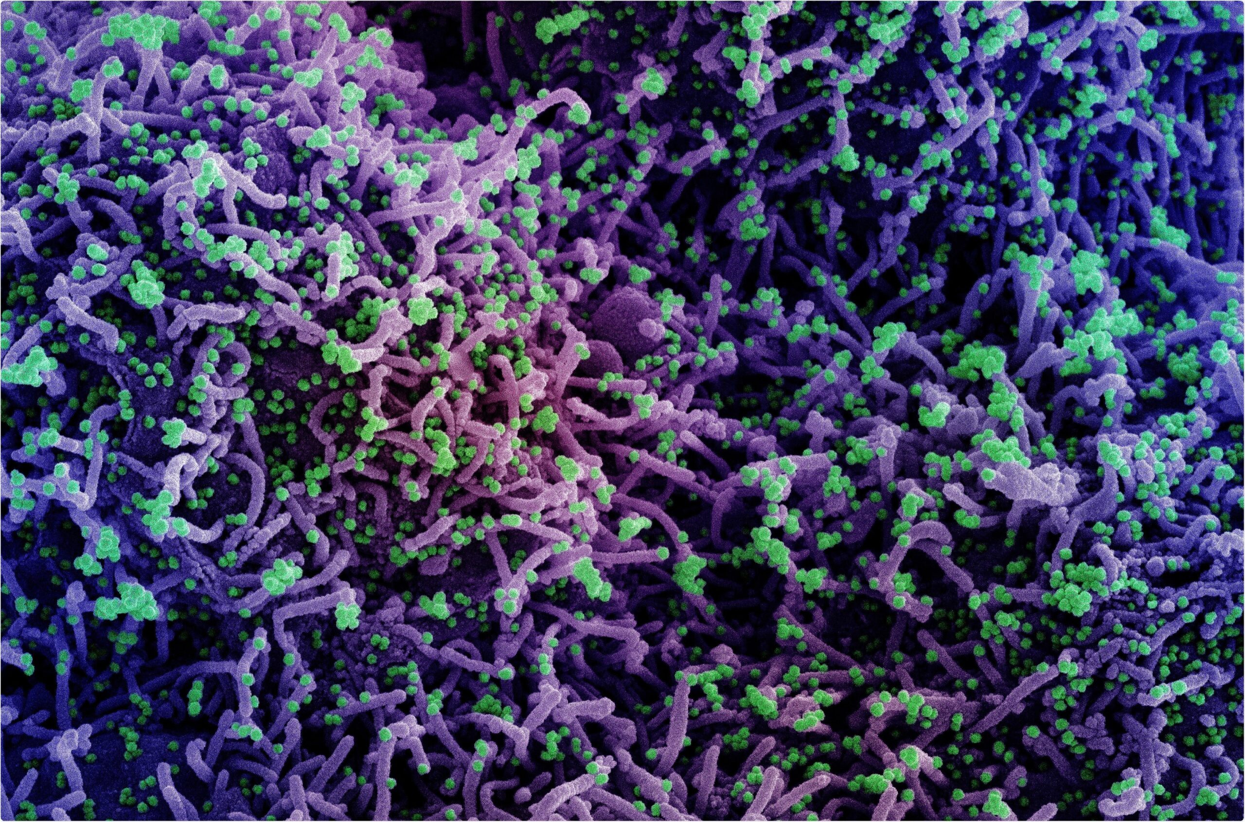 Study: The Chaotic Behavior of the Spread of Infection During the COVID-19 Pandemic in the United States and Globally. Image Credit: NIAID