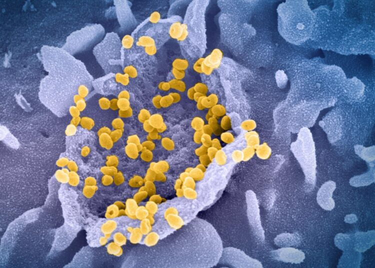 Study: Microglia do not restrict SARS-CoV-2 replication following infection of the central nervous system of K18-hACE2 transgenic mice. Image Credit: NIAID