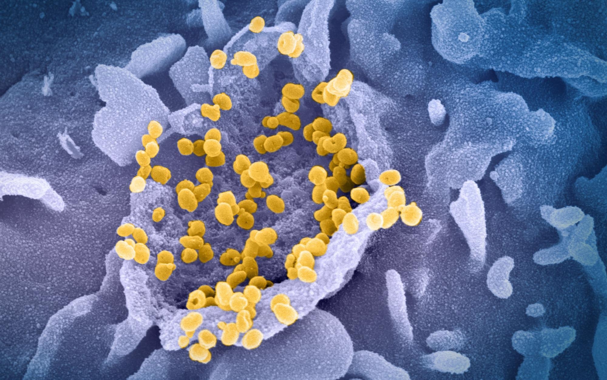 Study: Microglia do not restrict SARS-CoV-2 replication following infection of the central nervous system of K18-hACE2 transgenic mice. Image Credit: NIAID