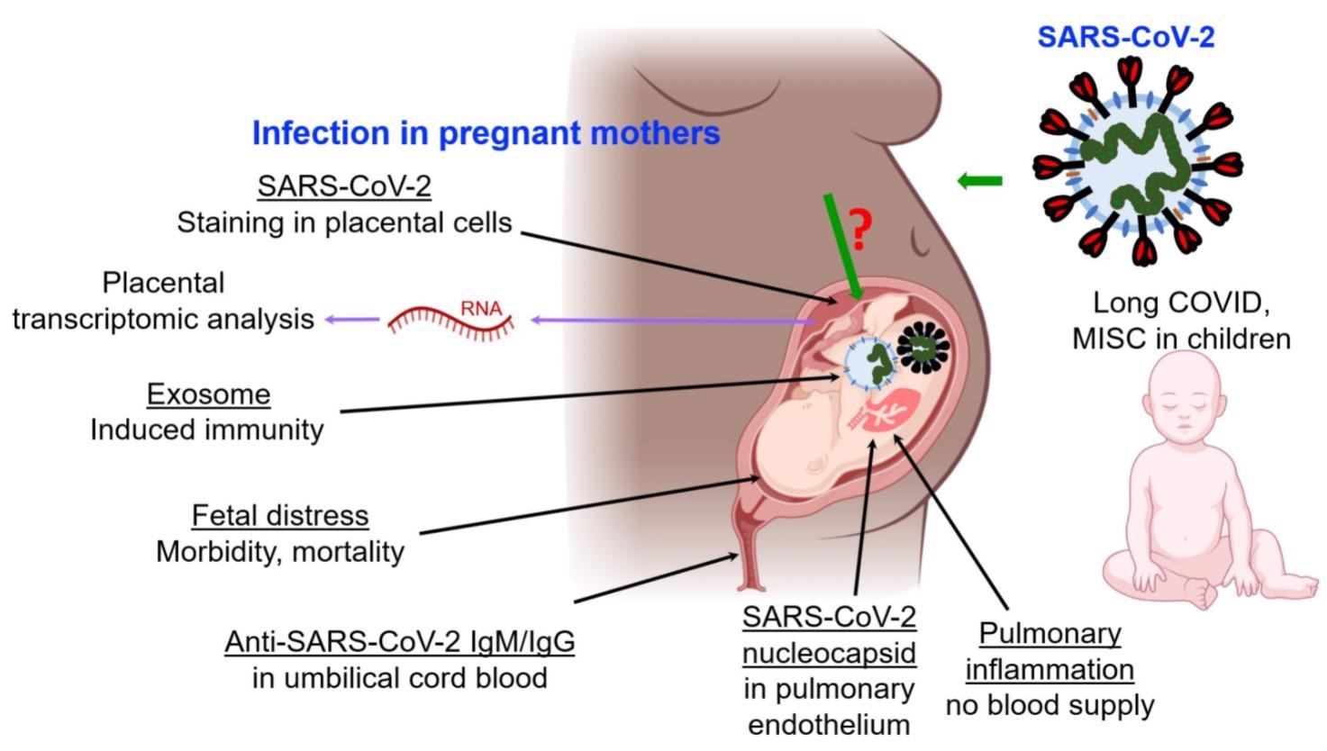 Infection et immunité au SRAS-CoV-2 pendant la grossesse et le développement fœtal