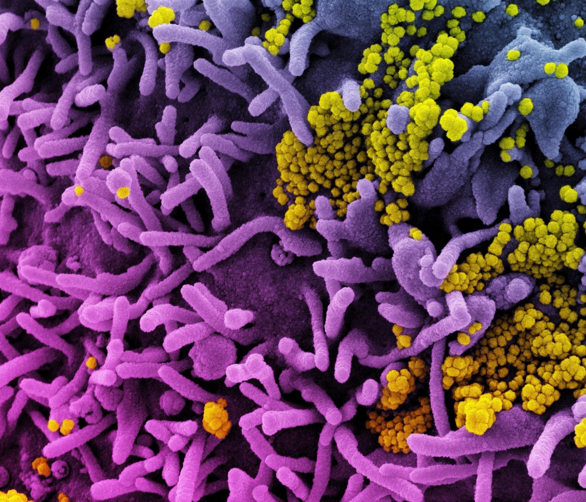 Study: The N-Terminal Carbamate is Key to High Cellular and Antiviral Potency for Boceprevir-Based SARS-CoV-2 Main Protease Inhibitors. Image Credit: NIAID