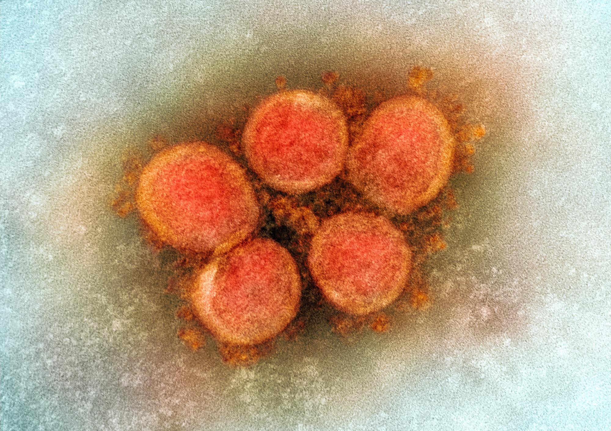 Les poches de liaison au sucre dans le domaine N-terminal peuvent augmenter l'infectiosité du SRAS-CoV-2