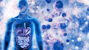 Le cancer colorectal