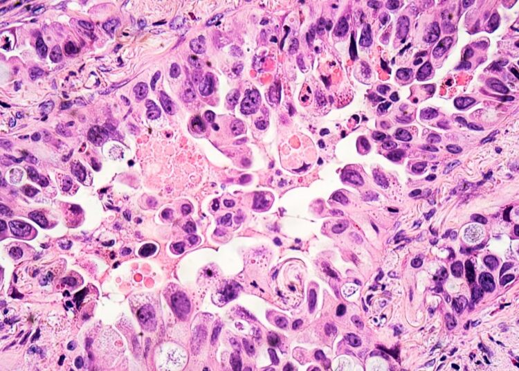 Study: The effect of COVID-19 mRNA vaccine on respiratory system: human lung carcinoma cells by means of Raman spectroscopy and imaging. Image Credit: David A Litman/Shutterstock