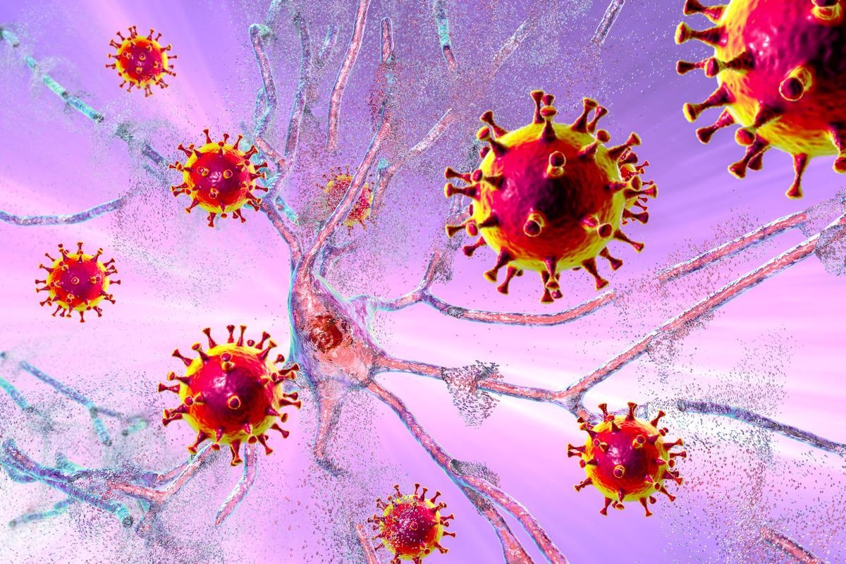 Study: Brain cortical changes are related to inflammatory biomarkers in hospitalized SARS-CoV-2 patients with neurological symptoms. Image Credit: Kateryna Kon/Shutterstock