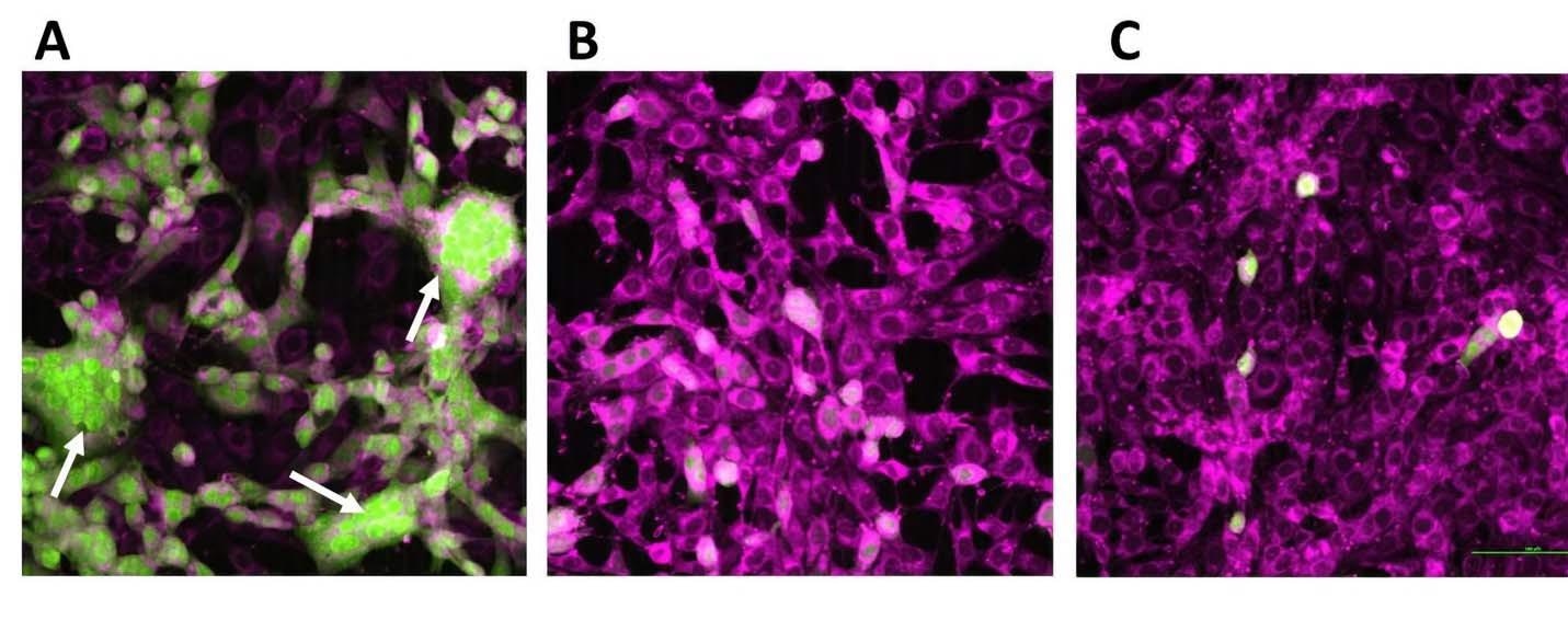 Les oligonucléotides empêchent l'infection induite par le MHV-A59-eGFP dans les cellules 17CL-1 secondaires marquées par fluorescence (de couleur magenta).  Après 24h d'infection des cellules primaires, des cellules secondaires de couleur magenta ont été ajoutées et imagées après 24h pour l'infection des cellules secondaires.  L'image représente l'infection primaire par le virus à 0,1 MOI pour 1h d'adsorption.  A. MHV-A59-eGFP avec polymer1.  B. MHV-A59-eGFP avec Polymer1 et oligonucléotide 1. C. MHV-A59-eGFP avec polymer1 et oligonucléotide 2. Les cellules arrondies, agrégées, fusionnées et granulées se détachant rapidement de la monocouche sont présentées dans le panneau A. La flèche dans le panneau indique syncytium induit par l'infection (grossissement original 10X).  Barre d'échelle 100 μm.