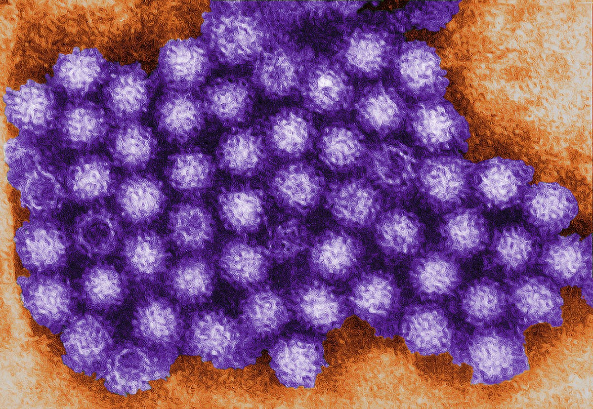 Les hôpitaux avertissent les patients de rester à l'écart alors que les épidémies de norovirus et de Covid frappent