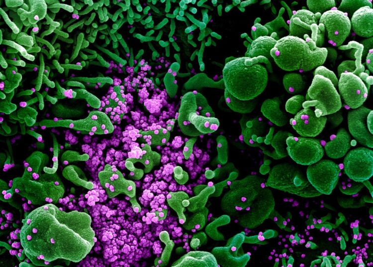 Study: Soluble P2X7 receptor is elevated in the plasma of COVID-19 patients and correlates with disease severity. Image Credit: NIAID