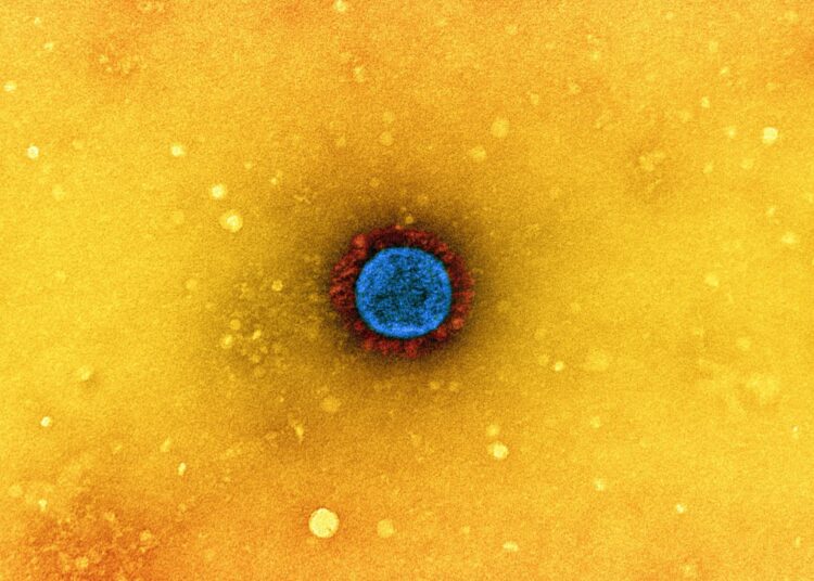 Study: Intragenomic rearrangements of SARS-CoV-2 and other β-coronaviruses. Image Credit: NIAID